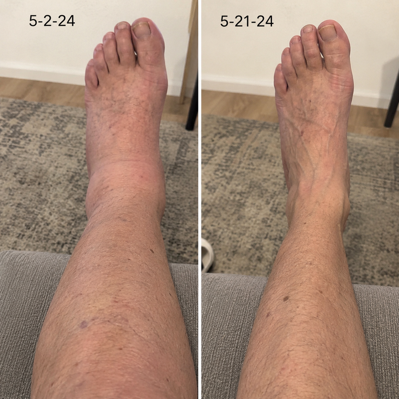 using Timboc less than 8 weeks