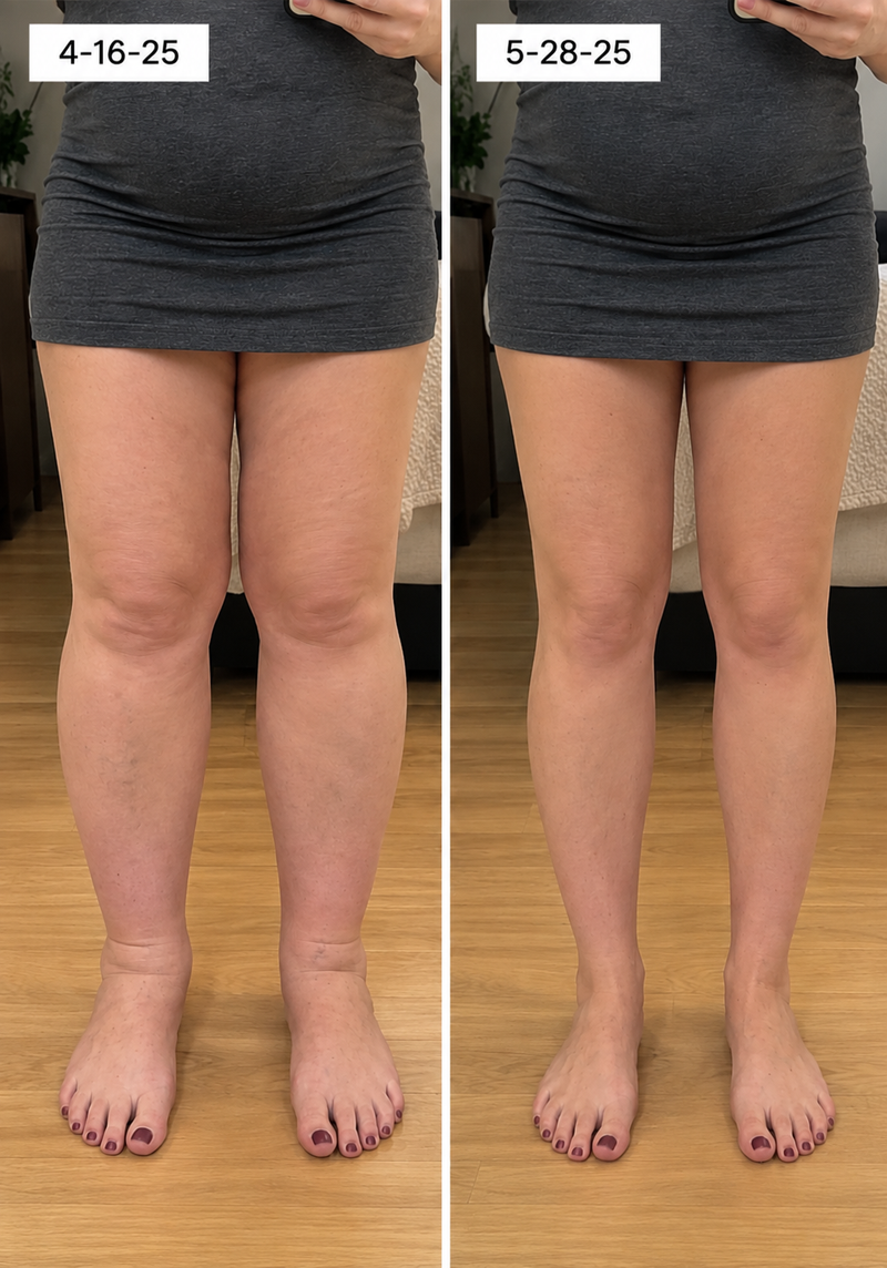 using Timboc less than 8 weeks