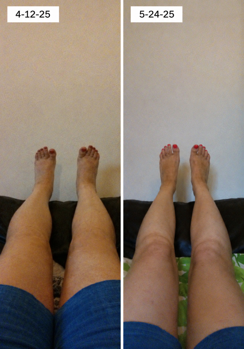 using Timboc less than 8 weeks