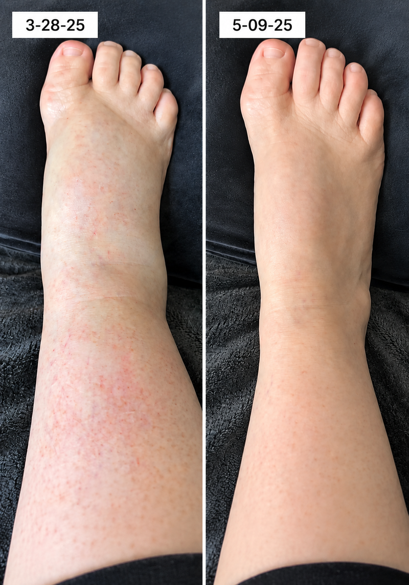 using Timboc less than 8 weeks